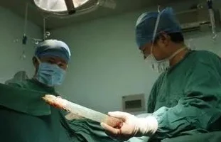 老太肛门异物取出竟是珍藏多年的玉镯引街坊邻居热议